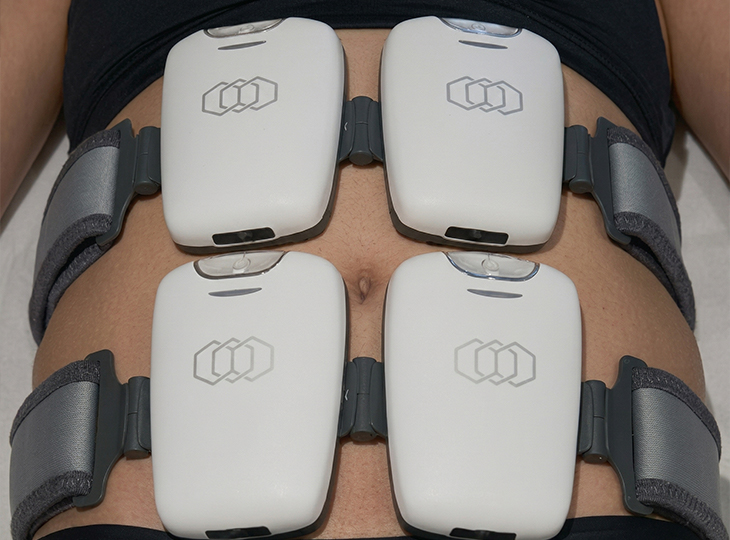 Evolve Tone muscle stimulation treatment